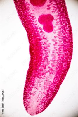  Echinostoma revolutum: This Tiny Parasite Prefers Your Gut Over Its Natural Freshwater Habitat!